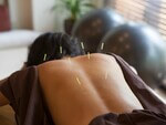Can I use acupuncture for back pain relief?