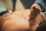 acupuncture for better sex