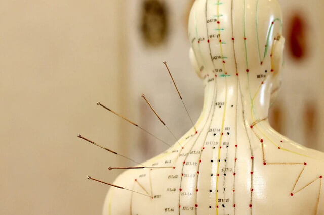 acupuncture pressure points on a person's back
